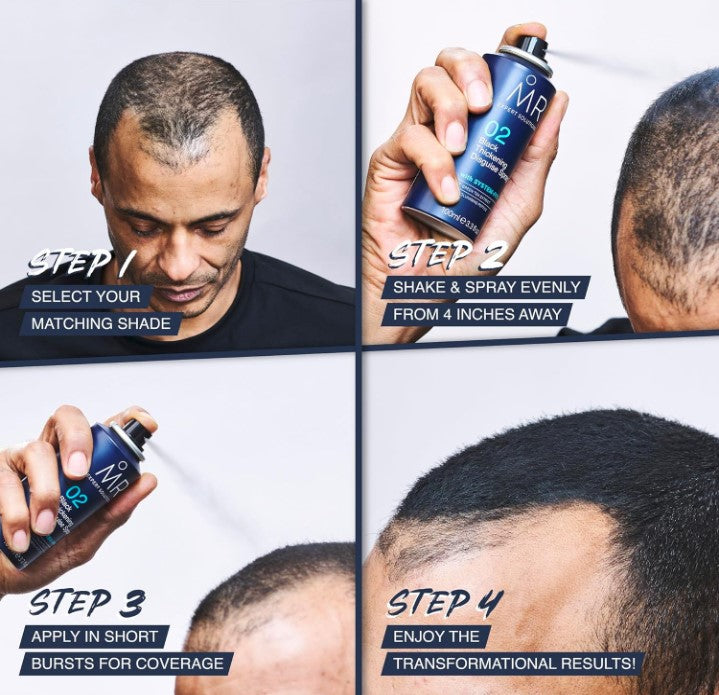 Balding hair subscription UK